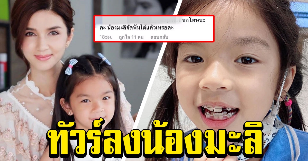 น้องมะลิ จัดฟันแล้ว