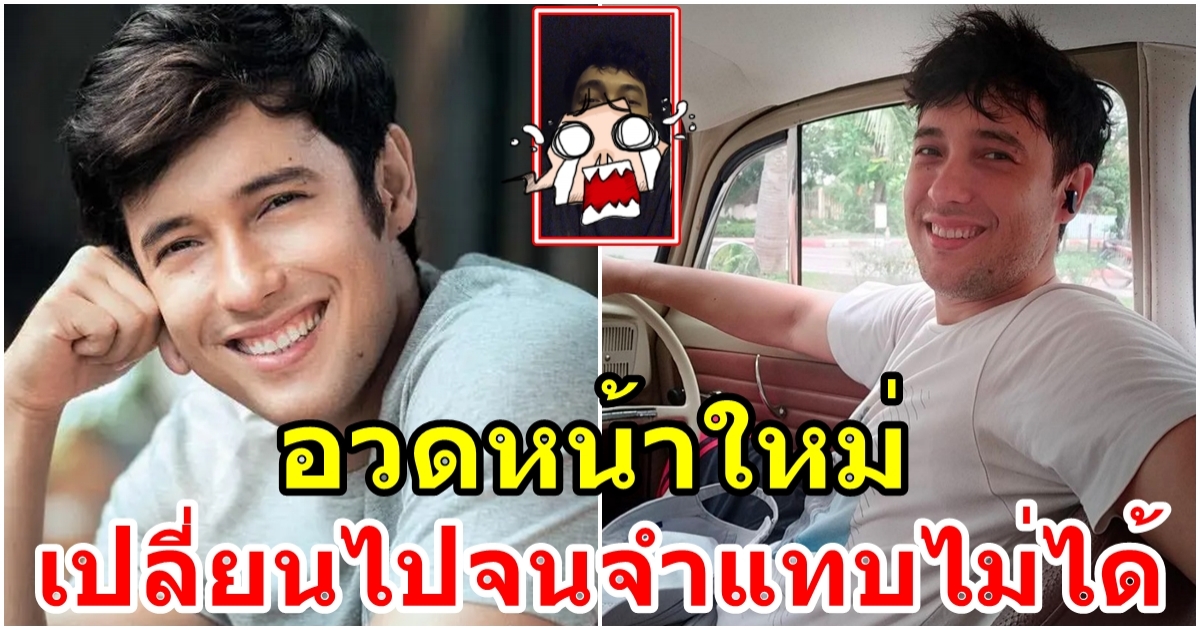 แอนดริว เกร้กสัน อวดหน้าใหม่ริมฝีปากอวบอิ่ม ตาค้างคอมเมนต์สนั่น