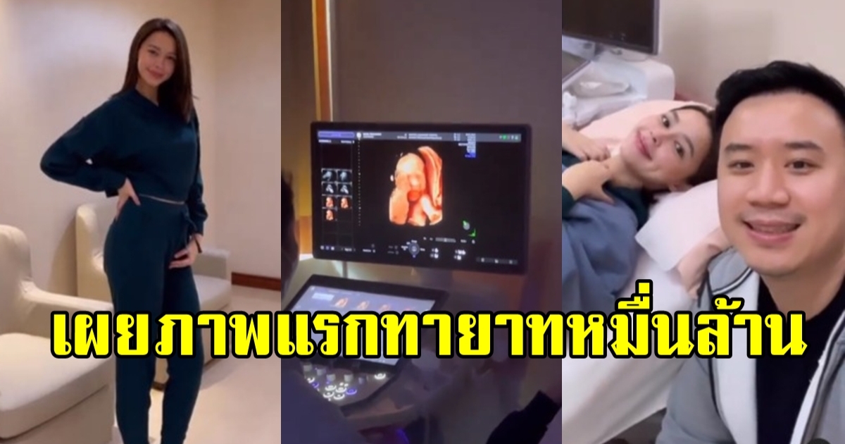 เผยภาพแรกทายาทหมื่นล้าน ลูกแพทริเซีย-โน้ต วิเศษ