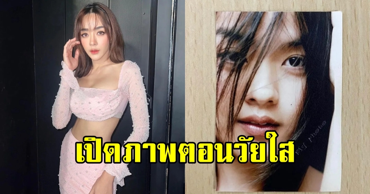 ปุยฝ้าย ณัฎฐพัชร์ เปิดหน้าเวอร์ชั่นออริจินอล ก่อนจัดฟัน-ฉีดดั้ง